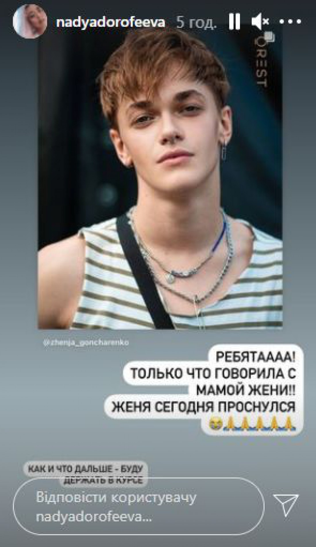 Надя Дорофеева рассказала о состоянии танцора 