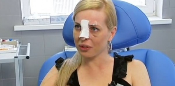 Таня Стребкова напугала лицом после пластики