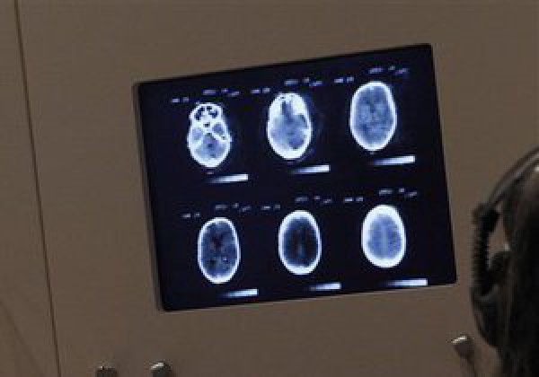 Ученые обнаружили в человеческом мозге центр чувства собственного превосходства