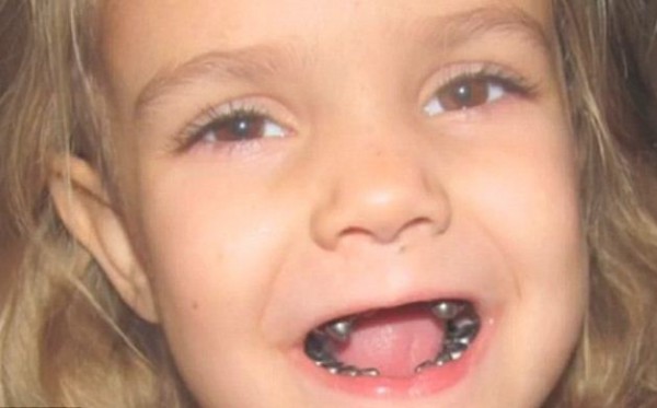 4-летняя Саванна после посещения стоматолога