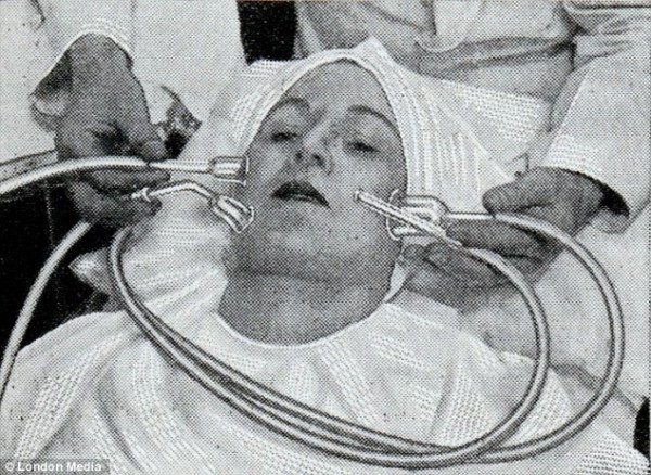 Изобретение с вакуумным насосом должно сделать вялую кожу упругой и гладкой