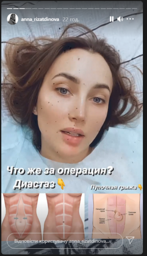 Анна Ризатдинова перенесла две операции