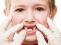 Как бороться с проблемными зубами у детей